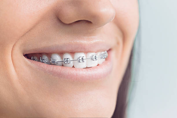 Best Invisalign and Clear Aligners  in Wilder, ID